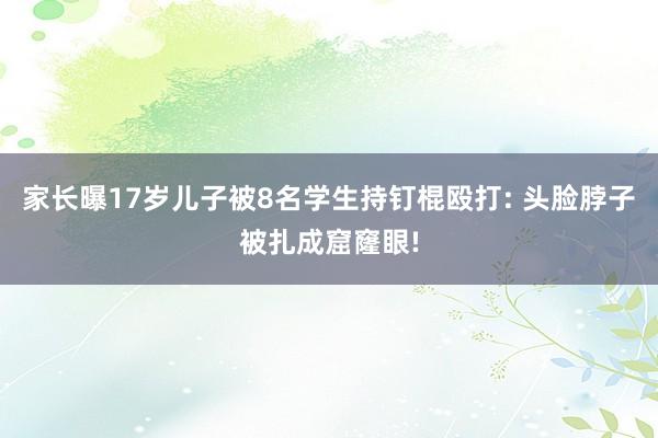 家长曝17岁儿子被8名学生持钉棍殴打: 头脸脖子被扎成窟窿眼!